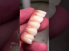 Excelente força Ti-Bar Zirconia ponte híbrida para dentes naturais e compatibilidade gengivas