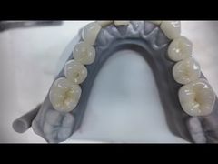 Prótese circónica que imita os dentes naturais
