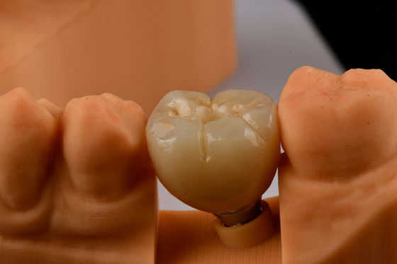 comprar Implantologia oral auto-toque Implantes dentários de dente único com conexão hexadecimal interna fabricação em linha