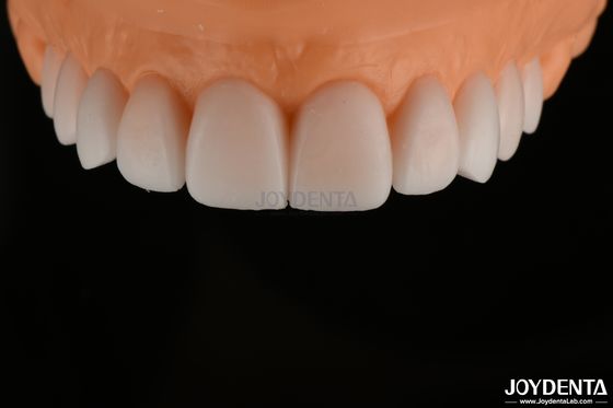 comprar Replicação de Diagnóstico Liso, Aplicação de Dentes de Arco Completo, Alta Precisão. fabricação em linha