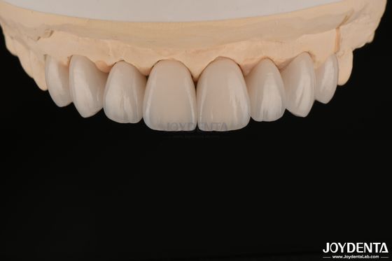 comprar Folheados Dentários Suaves e Leves, Biocompativeis e Confortáveis para a Saúde Oral fabricação em linha