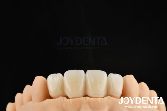 comprar Técnica de preparação orientada biologicamente BOPT para uma preparação dentária precisa fabricação em linha