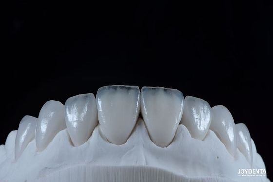comprar Aparência natural Emax Veneers de porcelana confortável Fit Ultra fina Emax Veneers fabricação em linha