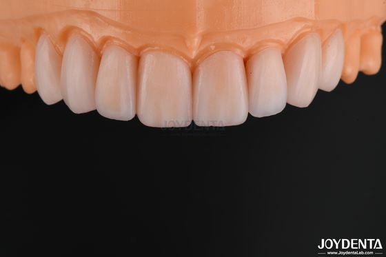 comprar Veneira de vidro cerâmica personalizável de aparência natural e alta resistência química fabricação em linha