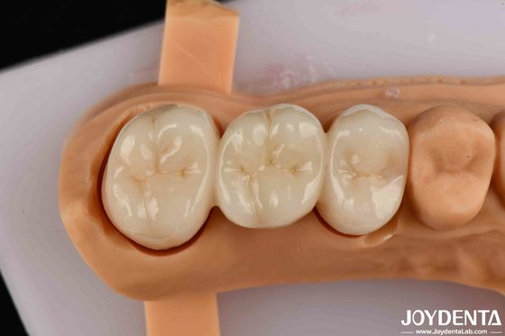 comprar Alta resistência flexural Zirconia de contorno completo para coroas Pontes Restauração dentária fabricação em linha