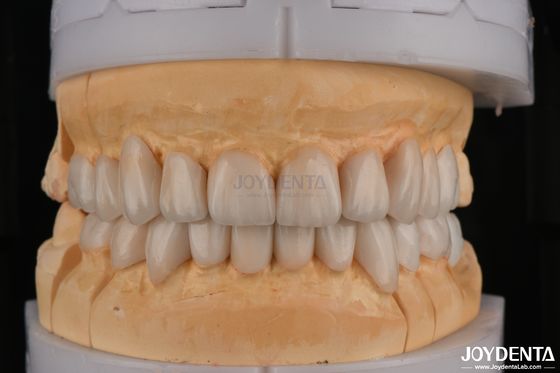 comprar Circónio em camadas de alta translucidez para restaurações dentárias de contorno completo fabricação em linha