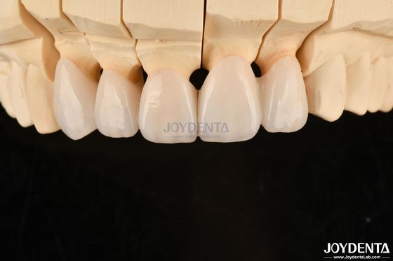 comprar Coroas e pontes dentárias de zircônio de camadas altamente personalizáveis Solução duradoura fabricação em linha