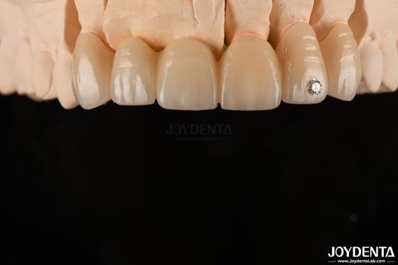 comprar CAD / CAM Moagem Dental Zirconia em camadas para coroas únicas 0.3-0.5mm espessura da camada fabricação em linha