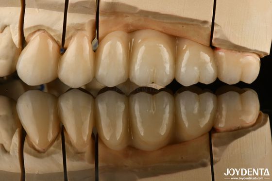 comprar Multicamadas de aparência natural Zirconia completa para restaurações dentárias Ultra translúcidas fabricação em linha