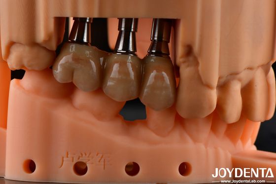 comprar Alta resistência flexural Multicamada Solução Dental de Zircônio Completo Restaurações de Arco Completo fabricação em linha