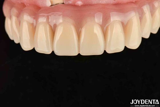 comprar Secagem rápida 5 minutos acabamento de dentes acrílico para restauração dentária fabricação em linha