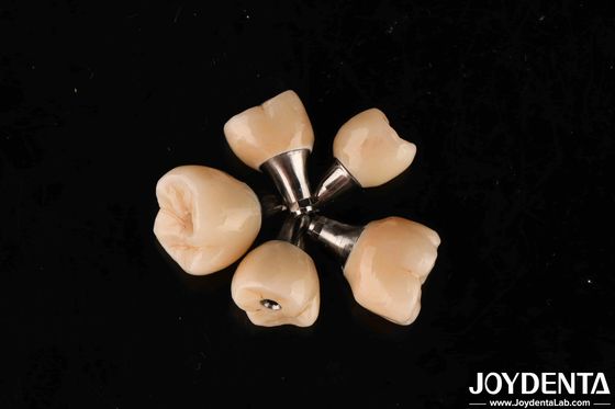comprar Conexão hexadecimal interna para implantes dentários fabricação em linha