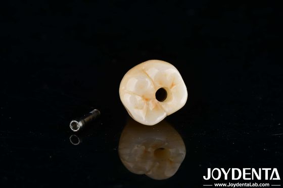 comprar Implantes dentários de titânio hexadecimal interno fabricação em linha