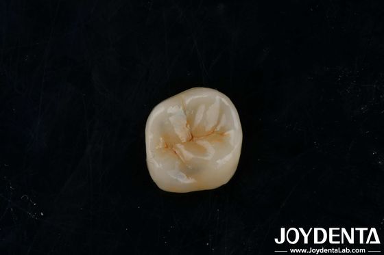 comprar Inlays de zircônio adesivo personalizável Onlays de alta translucidez para restauração fabricação em linha