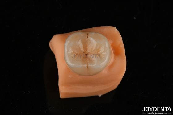 comprar 0.5mm resistente a manchas Emax Inlay Onlay adequado para restaurações dentárias fabricação em linha