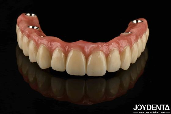 comprar Ponte Dental Híbrida de Titânio Personalizada Resistência à Corrosão Ajustável fabricação em linha