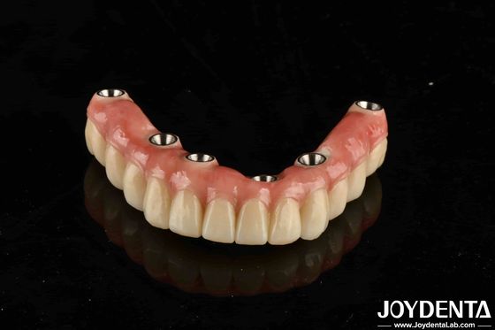 comprar Ponte de implantes dentários de titânio Malo combinando técnicas tradicionais e modernas fabricação em linha
