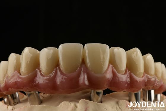 comprar Titânio Malong Dental Hybrid Bridge Durável Ajustado Fit Baixa densidade fabricação em linha