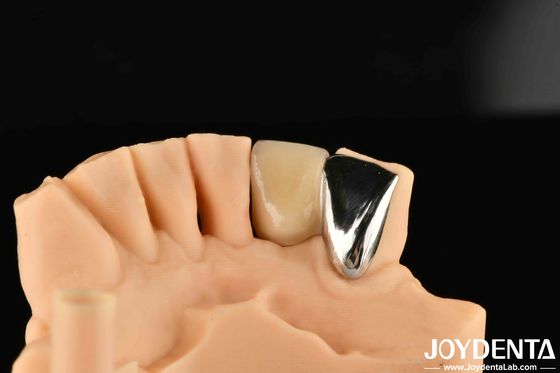 comprar Dental Metal / Maryland Bridege Oral Clinical Repair Metallic Ideal Color Clinical Bonding fabricação em linha
