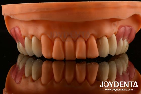 comprar Quadro Configuração Dentes Finalização Tecnologia Elaborada Design de Aparência Harmônica fabricação em linha