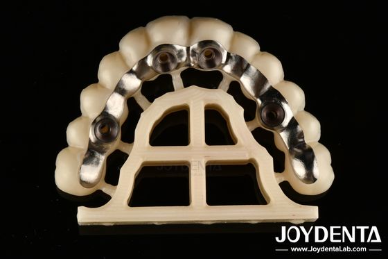 comprar Finitura de prata Abutments personalizados e barras de ajuste preciso parafusos retidos ou cimento retidos fabricação em linha