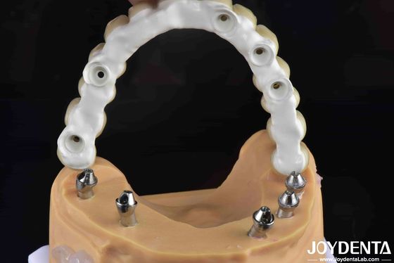 comprar Solução dentária de alta resistência à fratura de ponte de zircônio híbrida de base de Ti fabricação em linha