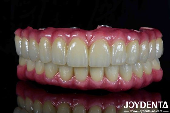 comprar Ponte híbrida de titânio leve para restauração dentária fabricação em linha
