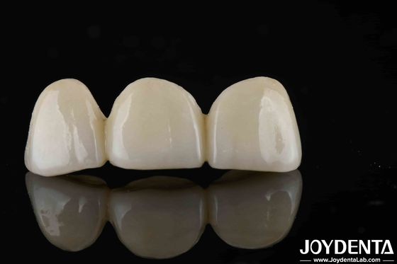 comprar Estilo de aparência natural com camadas de zircônio alta translucidez e estética fabricação em linha