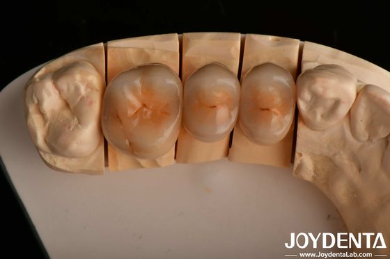 comprar Alta Resistência a Chipping e Estética de Aparência Natural com Tecnologia de Zirconia Completa Multicamadas fabricação em linha