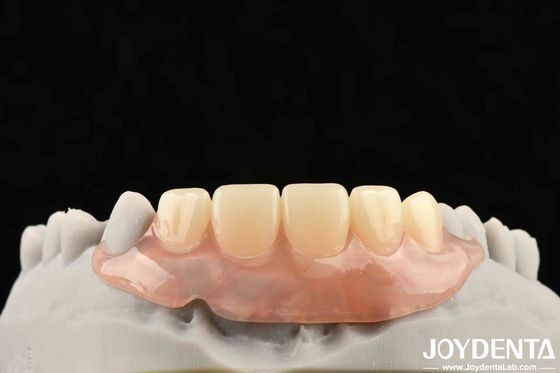 comprar Desenvolver um quadro tecnológico para o acabamento de dentes para uma estrutura oral estável Aplicar a tecnologia dentária fabricação em linha