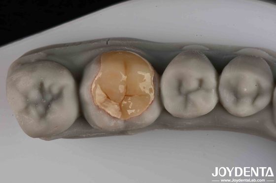 comprar Resistente ao desgaste Boa transparência Baixa resistência Emax Inlay Onlay para a sua eficiência operacional fabricação em linha