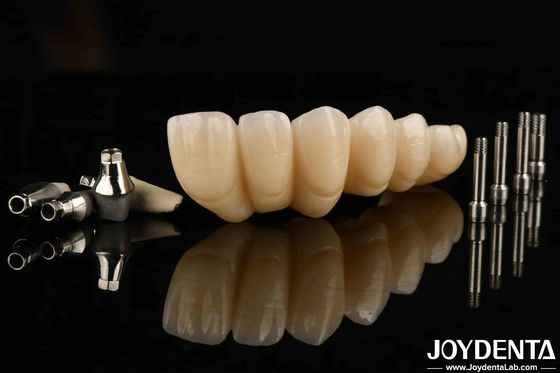 comprar Experimente a estética definitiva com o esteticamente agradável Implante Dental Coroa e Ponte fabricação em linha