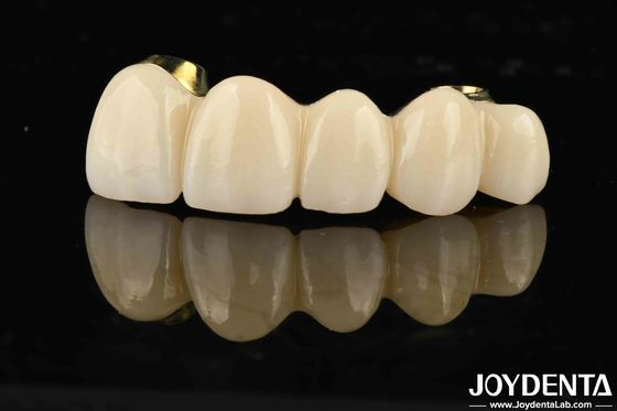 comprar Excelente força Ti-Bar Zirconia ponte híbrida para dentes naturais e compatibilidade gengivas fabricação em linha