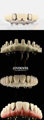 comprar Dental Estética Titânio Malong Hybrid Bridge Solução definitiva para restaurações dentárias fabricação em linha