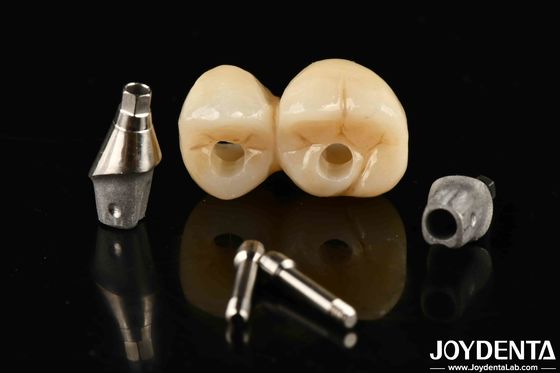 comprar Sistema de ponte de coroa com suporte a implantes com resistência a manchas e descoloração fabricação em linha