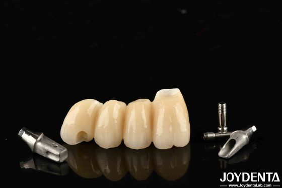 comprar Implante personalizável coroa e ponte em porcelana de precisão para função perfeita fabricação em linha