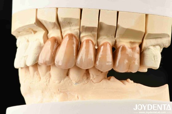 comprar Dentes Biônicos Zirconia em camadas com micro-gravação biônica de folhas e laminação biomimética multicolor para simulação avançada de luz fabricação em linha