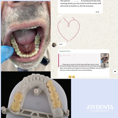 comprar Prótese circónica que imita os dentes naturais fabricação em linha