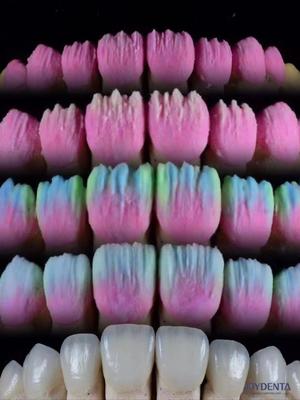 comprar The Joydenta Ceramic Veneer Process fabricação em linha