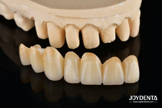 comprar Unveil True Biomimicry: Introducing Our Multi-Layered Zirconia Aesthetic Bridge fabricação em linha