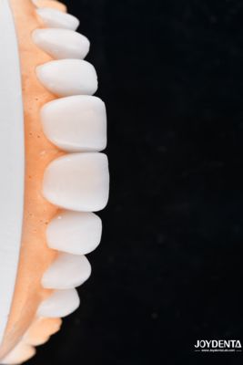 comprar Enhance Case Acceptance & Patient Communication with Our Diagnostic Wax-Up Service fabricação em linha