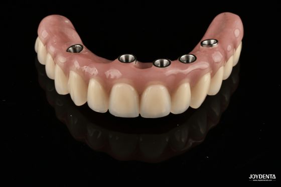 comprar Redefining Full Arch Prosthetics: Unmatched Fit and Function with Our Ti-Base Complete Dentures fabricação em linha