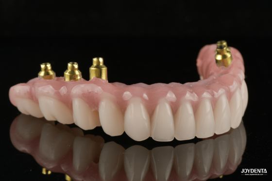 comprar The Strength of Titanium, The Art of Natural Aesthetics. fabricação em linha