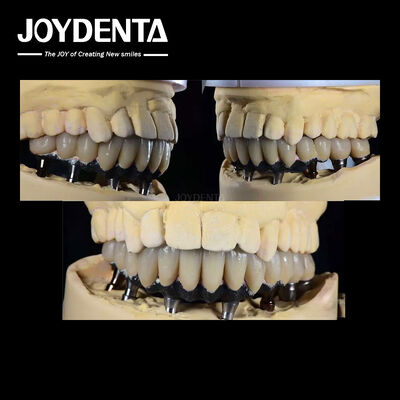 comprar Implante Dental de Dentes Múltiples de Titânio Cirurgia Protética Conexão Externa Hexagonal fabricação em linha