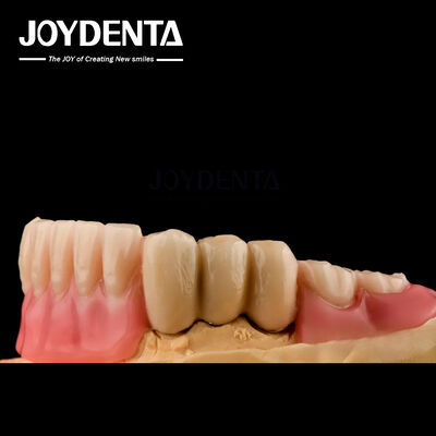 comprar Prótese de aço inoxidável Prótese dentária parcial Prótese de bola de superfície polida fabricação em linha