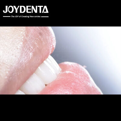 comprar Beneficios de revestimento dentário composto de longa duração Boa biocompatibilidade Sem queda de revestimentos de porcelana fabricação em linha