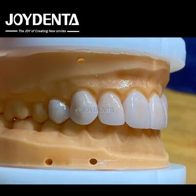 comprar Alta permeabilidade Veneers de aparência natural Veneers de porcelana Emax personalizado fabricação em linha