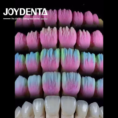 comprar The Joydenta Ceramic Veneer Process fabricação em linha