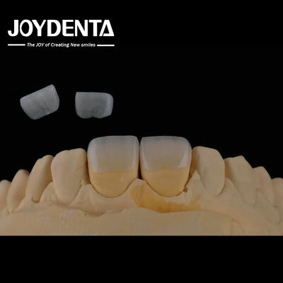 comprar Dentária de longa duração Finete feldspático Cor natural dos dentes Aparência translúcida fabricação em linha