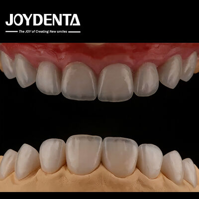 comprar Veneers de porcelana cosmética com forte adesão. fabricação em linha